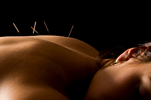 Acupuncture and Soft Tissue Pain